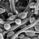 A scanning electron micrograph of Candida albicans in its more pathogenic, multicellular form.